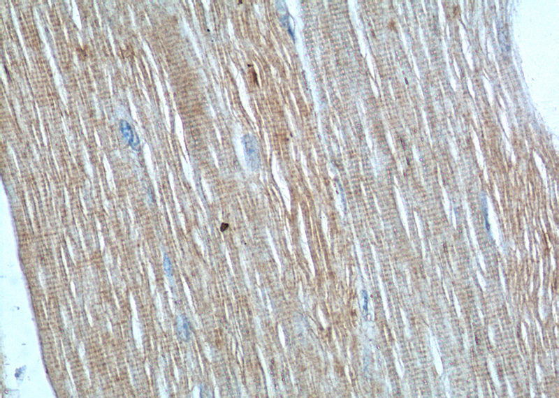 Immunohistochemistry of paraffin-embedded human skeletal muscle tissue slide using Catalog No:114315(PTPN11 Antibody) at dilution of 1:50 (under 40x lens)