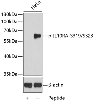 Western blot - Phospho-IL10RA-S319/S323 pAb 