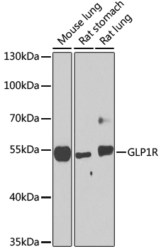 Western blot - GLP1R Polyclonal Antibody 