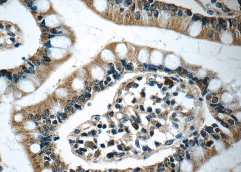 Immunohistochemistry of paraffin-embedded human small intestine tissue slide using Catalog No:111723(humanin Antibody) at dilution of 1:50 (under 40x lens)