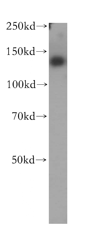 human placenta tissue were subjected to SDS PAGE followed by western blot with Catalog No:111863(ITGB3 antibody) at dilution of 1:300