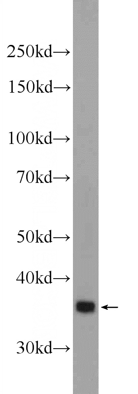 mouse brain tissue were subjected to SDS PAGE followed by western blot with Catalog No:116026(TGIF2 Antibody) at dilution of 1:600