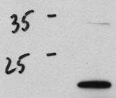 WB result of anti-CNPY2 (Catalog No:109356, 1:2000) with 40ug Huh7 cells by Dr.Dan Lindholm.