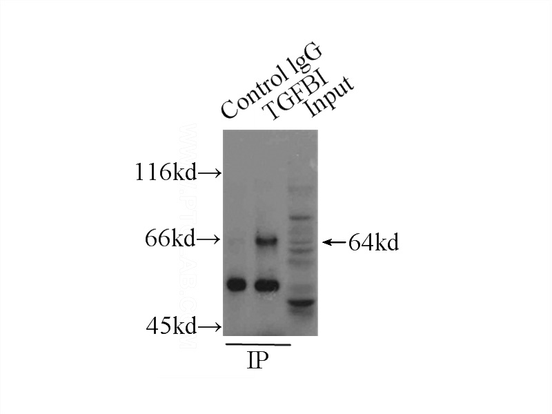 IP Result of anti-BIGH3 (IP:Catalog No:116022, 3ug; Detection:Catalog No:116022 1:300) with HeLa cells lysate 1000ug.