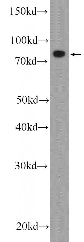 HepG2 cells were subjected to SDS PAGE followed by western blot with Catalog No:115854(TARS2 Antibody) at dilution of 1:600