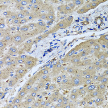 Immunohistochemistry - UGT2B10 Polyclonal Antibody 