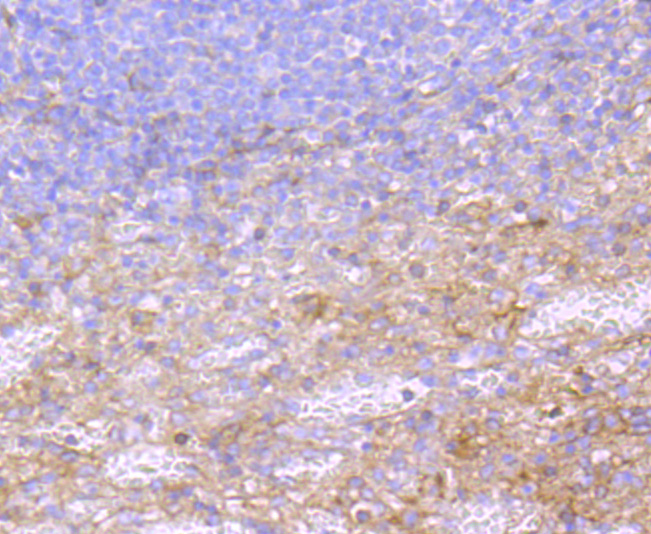 Fig4: Immunohistochemical analysis of paraffin-embedded human spleen tissue using anti- A2M antibody. Counter stained with hematoxylin.