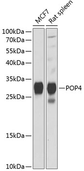 Western blot - POP4 Polyclonal Antibody 