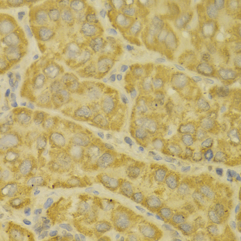 Immunohistochemistry - MAOA Polyclonal Antibody 