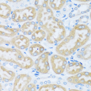 Immunohistochemistry - BRSK1 Polyclonal Antibody 