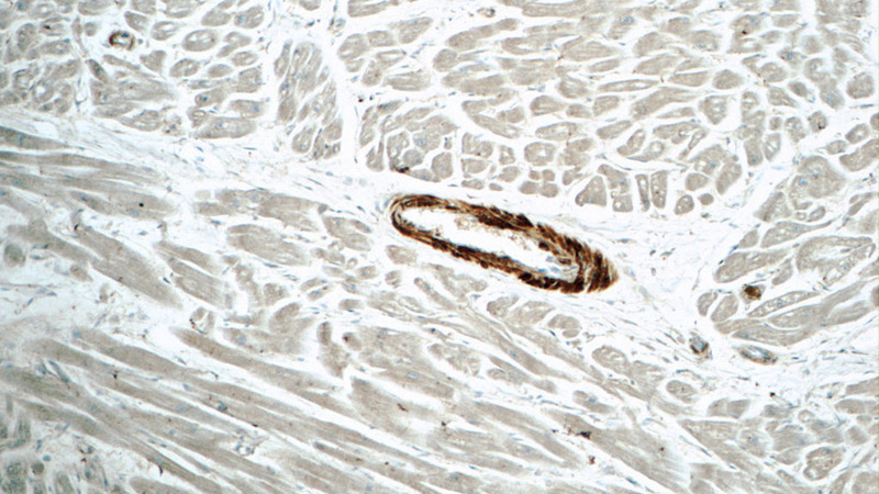 Immunohistochemistry of paraffin-embedded human heart tissue slide using Catalog No:108906(Calponin Antibody) at dilution of 1:50 (under 10x lens)