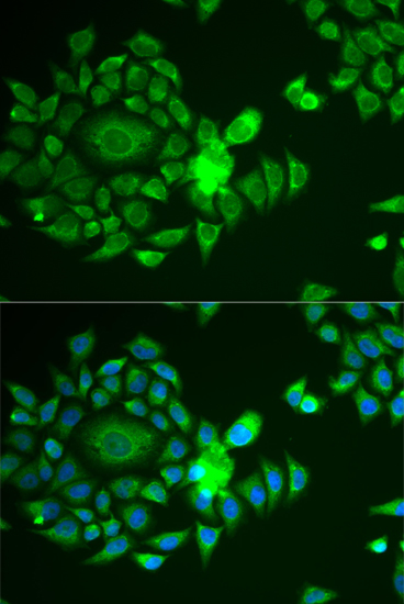 Immunofluorescence - NDUFS4 Polyclonal Antibody 