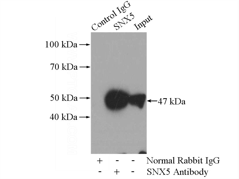 IP Result of anti-SNX5 (IP:Catalog No:115483, 4ug; Detection:Catalog No:115483 1:500) with mouse kidney tissue lysate 4000ug.