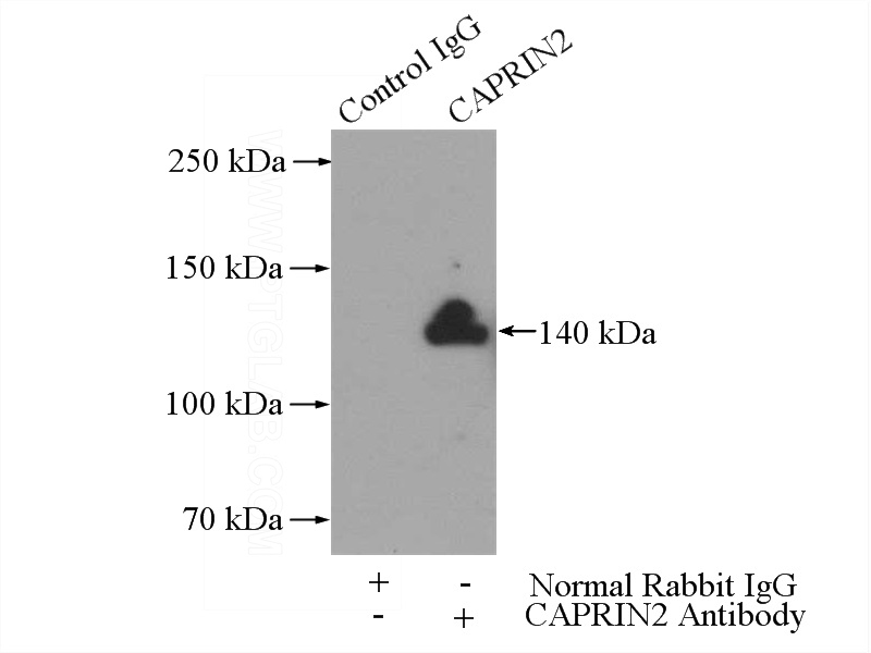 IP Result of anti-CAPRIN2 (IP:Catalog No:108840, 4ug; Detection:Catalog No:108840 1:300) with SH-SY5Y cells lysate 3000ug.