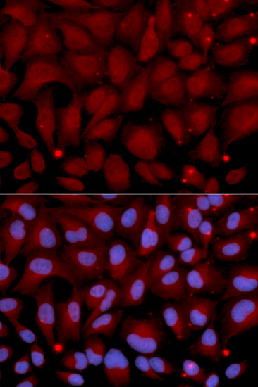 Immunofluorescence - BCHE Polyclonal Antibody 