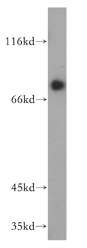 mouse kidney tissue were subjected to SDS PAGE followed by western blot with Catalog No:117341(TF antibody) at dilution of 1:400