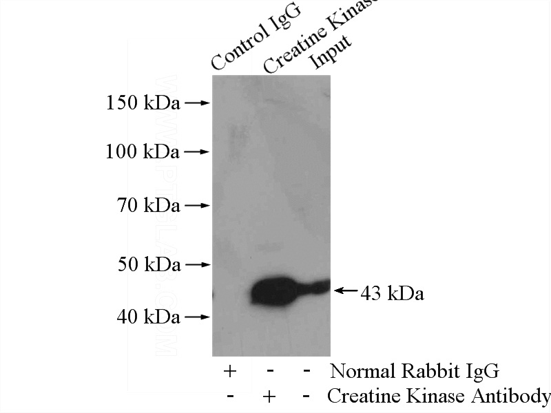 Creatine Kinase MSpecific Rabbit Polyclonal antibody
