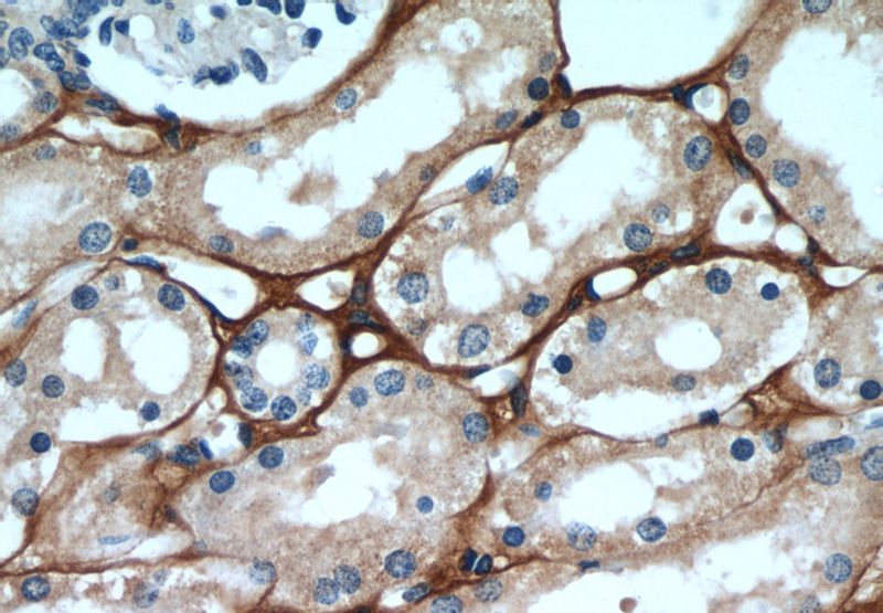 Immunohistochemical of paraffin-embedded human kidney using Catalog No:116022(BIGH3 antibody) at dilution of 1:50 (under 40x lens)