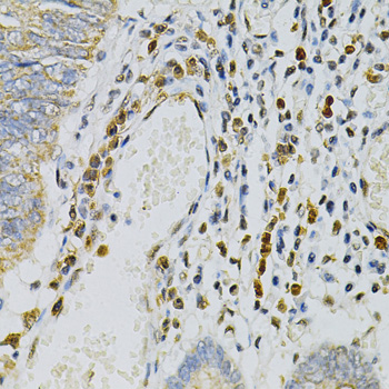 Immunohistochemistry - CDA Polyclonal Antibody 