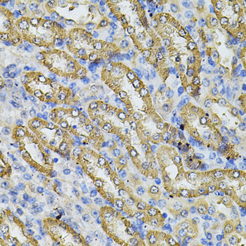 Immunohistochemistry - SPTLC1 Polyclonal Antibody 