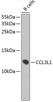 Western blot - CCL3L1 Polyclonal Antibody 