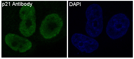 Immunofluorescent analysis of MCF7 cells, using p21 Antibody.