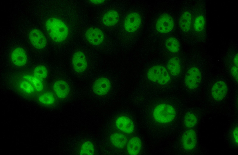 Immunofluorescent analysis of (10% Formaldehyde) fixed MCF-7 cells using Catalog No:108134(ANAPC2 Antibody) at dilution of 1:50 and Alexa Fluor 488-congugated AffiniPure Goat Anti-Rabbit IgG(H+L)