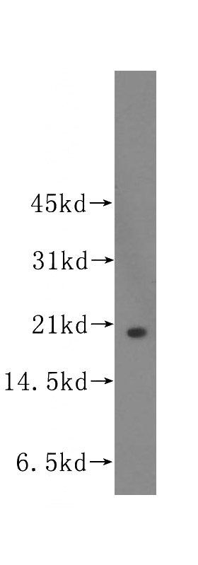 HeLa cells were subjected to SDS PAGE followed by western blot with Catalog No:116517(UBE2C antibody) at dilution of 1:500