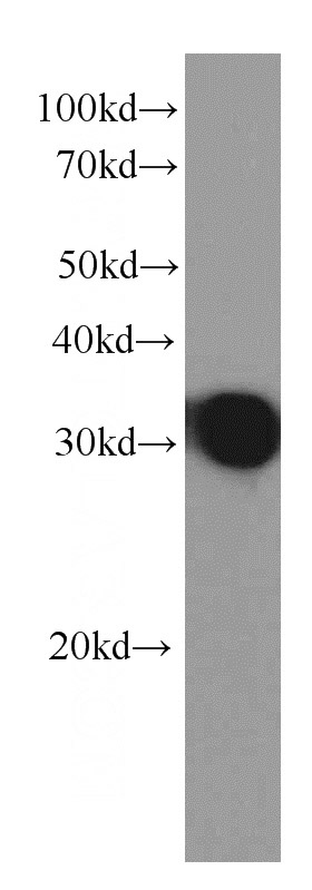 IL27 fusion protein were subjected to SDS PAGE followed by western blot with Catalog No:107395(IL27 Antibody) at dilution of 1:5000