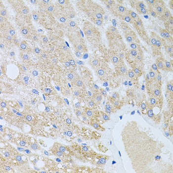Immunohistochemistry - DLK1 Polyclonal Antibody 