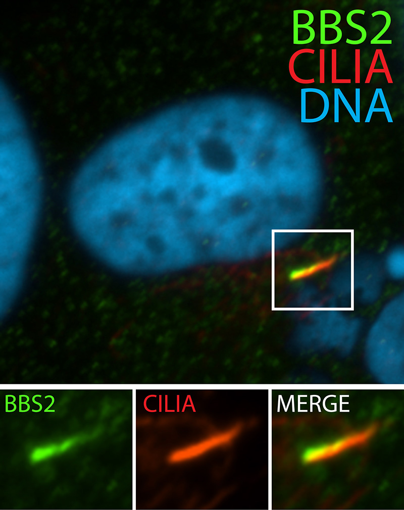 IF result (cilia stain) of anti-BBS2 (Catalog No:108369, 1:50) with serum-starved hTERT-RPE1 cells by Dr. Moshe Kim.