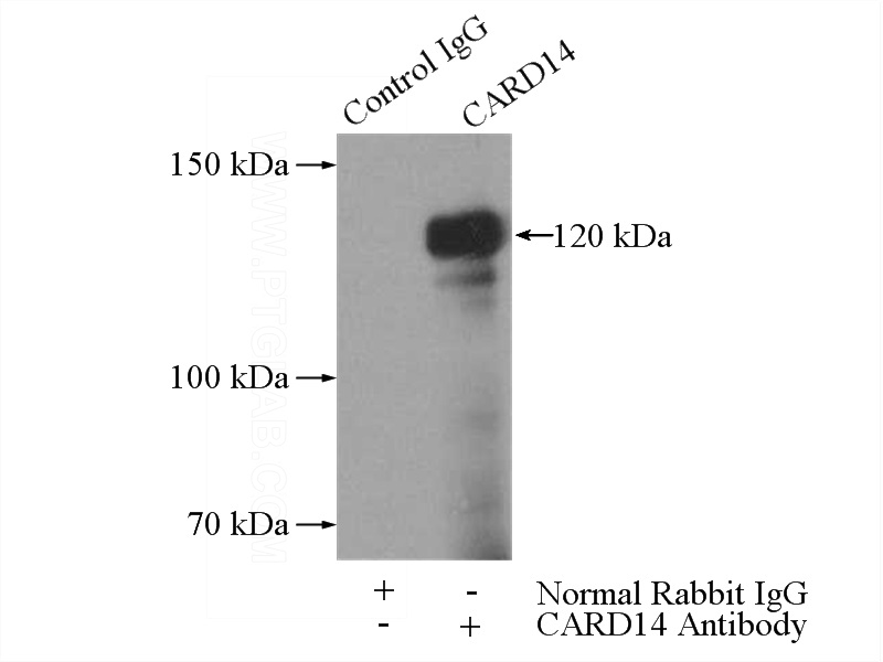 IP Result of anti-CARD14 (IP:Catalog No:108855, 4ug; Detection:Catalog No:108855 1:300) with HeLa cells lysate 2440ug.