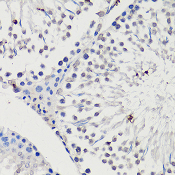 Immunohistochemistry - WT1 Polyclonal Antibody 