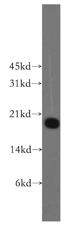 K-562 cells were subjected to SDS PAGE followed by western blot with Catalog No:114114(PPP3R1 antibody) at dilution of 1:400