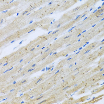 Immunohistochemistry - CLIP1 Polyclonal Antibody 