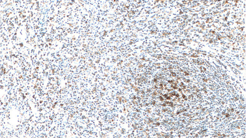 Immunohistochemistry of paraffin-embedded human tonsillitis tissue slide using Catalog No:107459(PD-1/CD279 Antibody) at dilution of 1:200 (under 10x lens). Heat mediated antigen retrieved with Tris-EDTA buffer, pH9.0