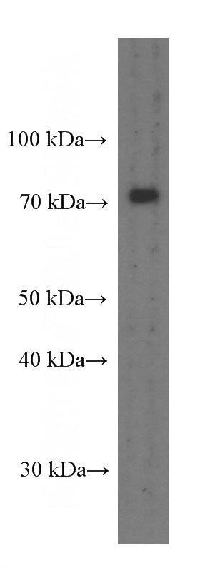 pig brain tissue were subjected to SDS PAGE followed by western blot with Catalog No:107465(PEX5 Antibody) at dilution of 1:1000