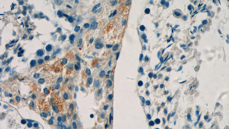 Immunohistochemistry of paraffin-embedded mouse testis tissue slide using Catalog No:109495(COX6B2 Antibody) at dilution of 1:50 (under 40x lens)