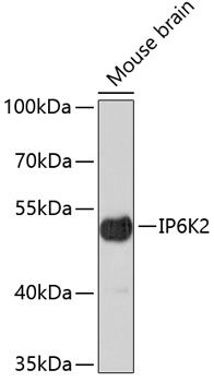 Western blot - IP6K2 Polyclonal Antibody 