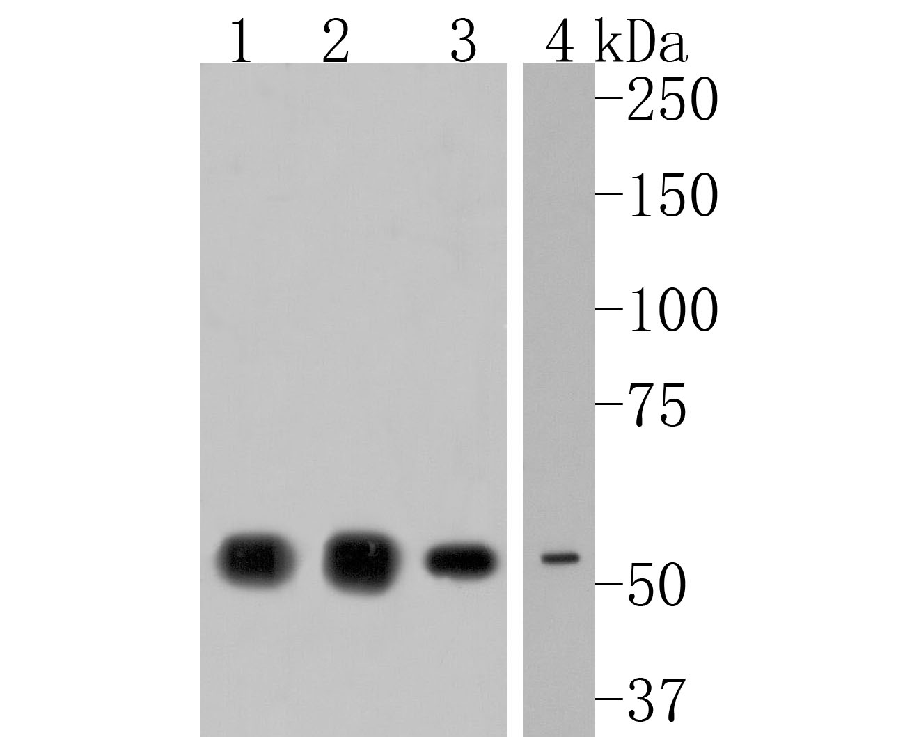 Fig1:; Western blot analysis of NPY5R on different lysates. Proteins were transferred to a PVDF membrane and blocked with 5% NFTM/TBST for 1 hour at room temperature. The primary antibody ( 1/500) was used in 5% NFTM/TBST at room temperature for 2 hours. Goat Anti-Rabbit IgG - HRP Secondary Antibody (HA1001) at 1:200,000 dilution was used for 1 hour at room temperature.; Positive control:; Lane 1: Human brain tissue lysate; Lane 2: Rat brain tissue lysate; Lane 3: A549 cell lysate; Lane 4: Mouse spleen tissue lysate