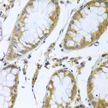 Immunohistochemistry - FBXL5 Polyclonal Antibody 
