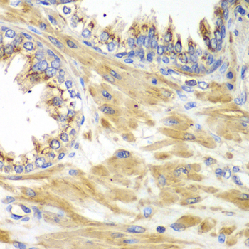 Immunohistochemistry - PICK1 Polyclonal Antibody 