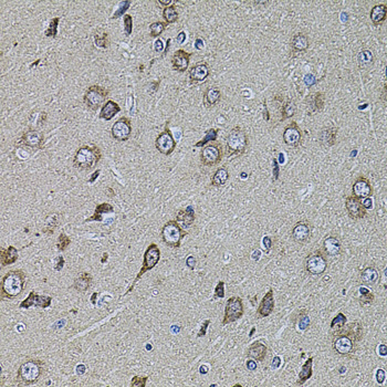 Immunohistochemistry - UQCRC1 Polyclonal Antibody 