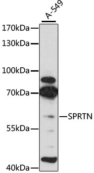 Western blot - SPRTN Polyclonal Antibody 