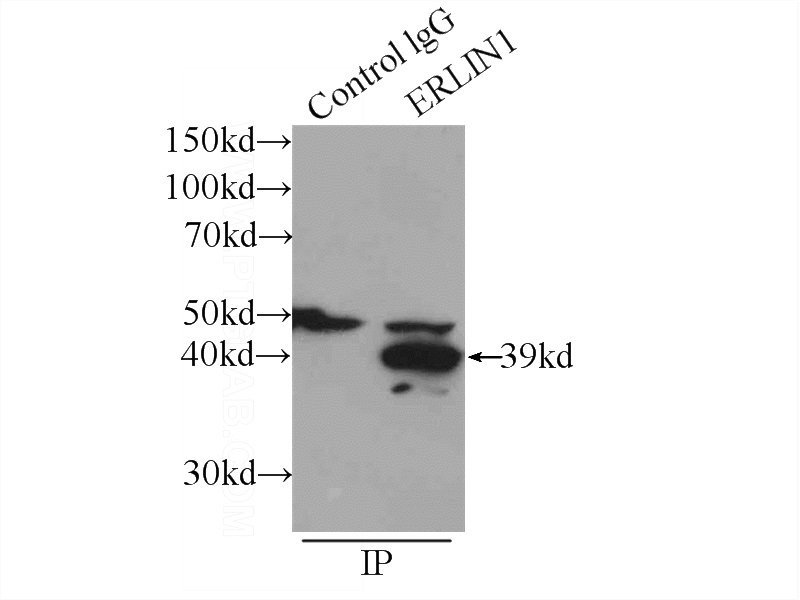 IP Result of anti-ERLIN1 (IP:Catalog No:110364, 3ug; Detection:Catalog No:110364 1:1000) with mouse heart tissue lysate 4000ug.