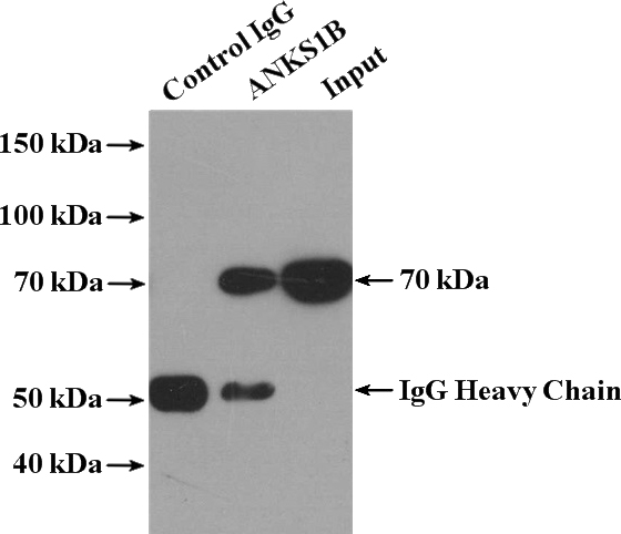 IP Result of anti-ANKS1B (IP:Catalog No:108085, 4ug; Detection:Catalog No:108085 1:1000) with HeLa cells lysate 3200ug.