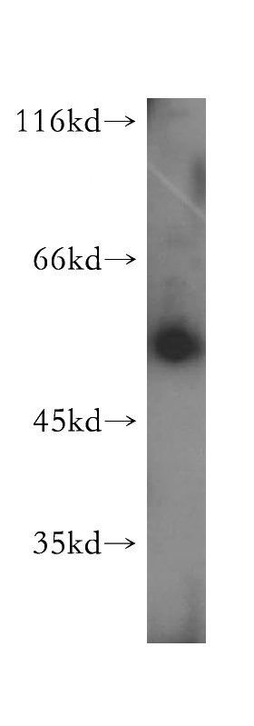 human stomach tissue were subjected to SDS PAGE followed by western blot with Catalog No:113574(PAOX antibody) at dilution of 1:500
