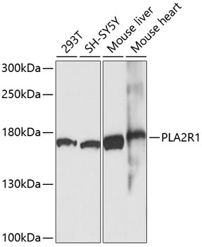 Western blot - PLA2R1 Polyclonal Antibody 