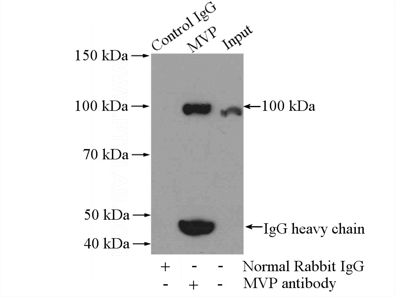 IP Result of anti-MVP (IP:Catalog No:112907, 4ug; Detection:Catalog No:112907 1:500) with mouse lung tissue lysate 4000ug.