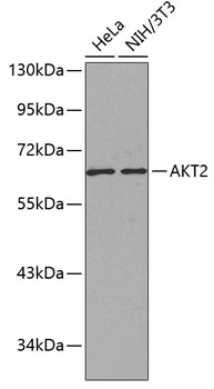 Western blot - AKT2 Polyclonal Antibody 